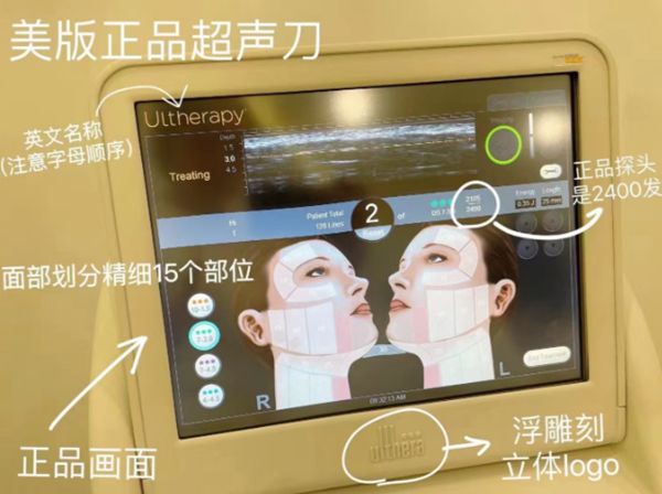 韓國do臉超聲刀價格表:韓版1.5-2萬,美版2-3萬,2026官方報價+含稅明細全公開插图 韓國do臉超聲刀價格表