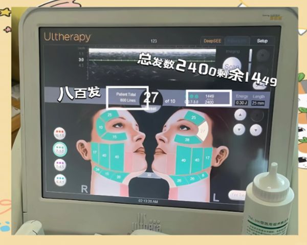 韓國do臉超聲刀價格表:韓版1.5-2萬,美版2-3萬,2026官方報價+含稅明細全公開插图2 為什麼韓國do臉超聲刀價格表有差異